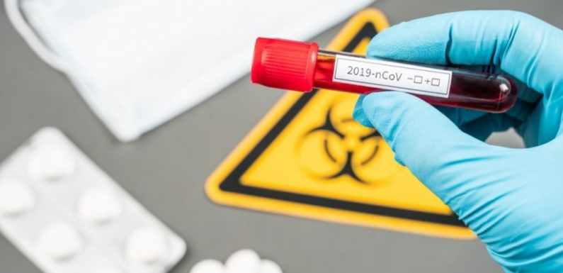 COVID19, SRBIJA: 72 NOVOINFICIRANE OSOBE