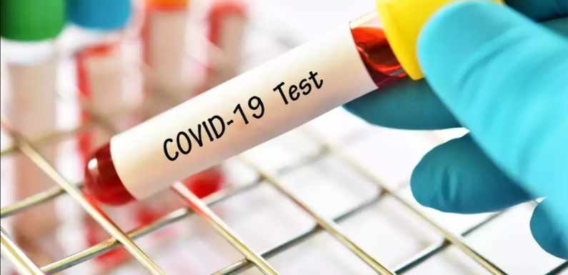 COVID19, SRBIJA: DANAS JOŠ 68 NOVOINFICIRANIH OSOBA
