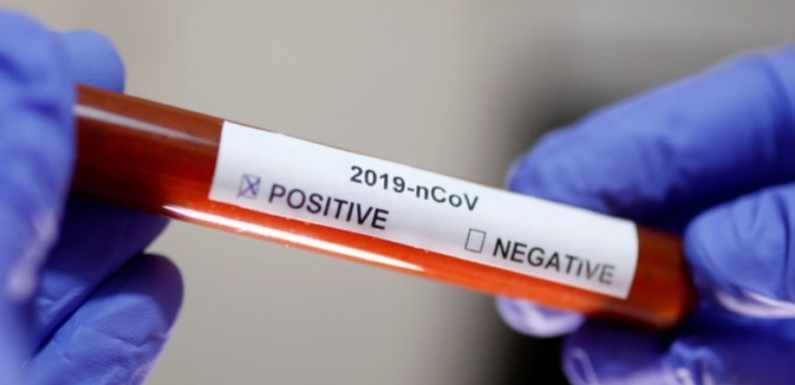 COVID19, SRBIJA: 2.873 OSOBE HOSPITALIZOVANE, NA RESPIRATORIMA 107