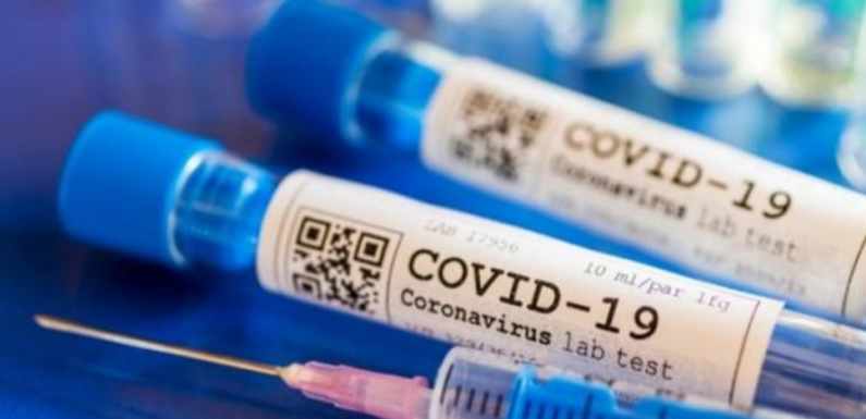COVID19, IZVEŠTAJ ZA RASINSKI OKRUG, 06.08.2020.