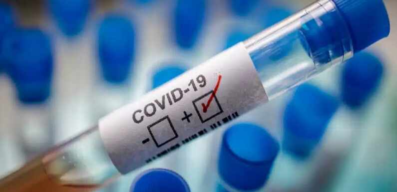 COVID19, IZVEŠTAJ ZA RASINSKI OKRUG, 18.08.2020.
