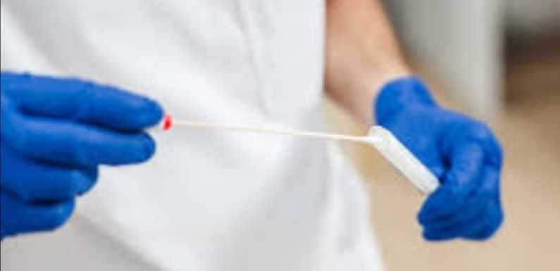 COVID19, SRBIJA: PREKO MILION TESTIRANIH OD POČETKA EPIDEMIJE